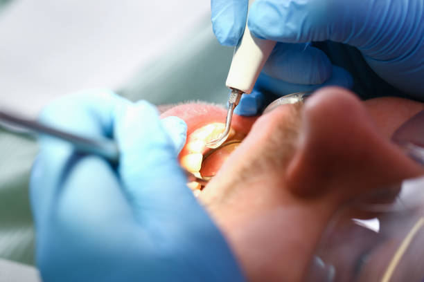 Best Emergency Denture Repair in O, MI