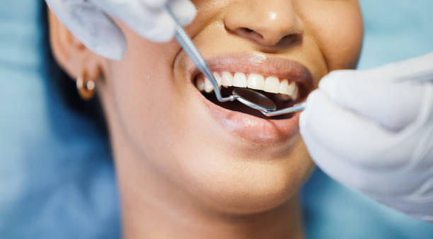 Best Emergency Gum Treatment in O, MI