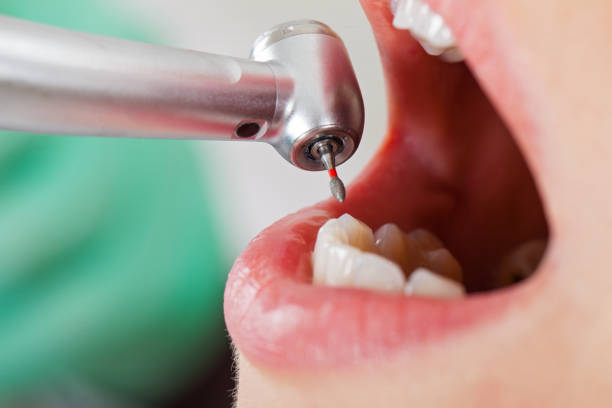 Best Emergency Treatment for Dental Infections or Abscesses in O, MI